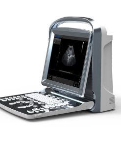 132970_chison_eco1_vet-247x296 CHISON ECO 1