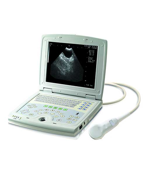 HTB1fTZsGXXXXXXzapXXq6xXFXXX7-2 KX5000 Laptop Ultrasound