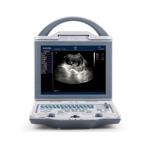 KX56000-Ultrasound-510x511 Rechargeable Human Ultrasound Scanner -KX5600