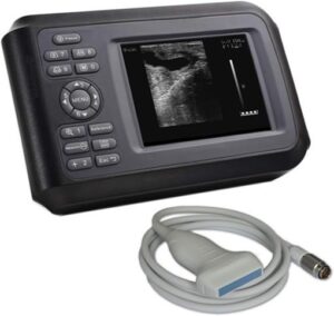 US-B20A-Full-Digital-Handheld-Ultrasound-510x482 US-B20A Full Digital Handheld Ultrasound