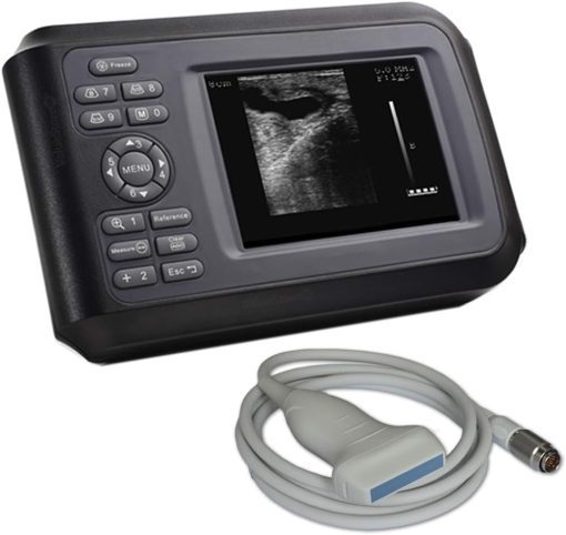 US-B20A Full Digital Handheld Ultrasound
