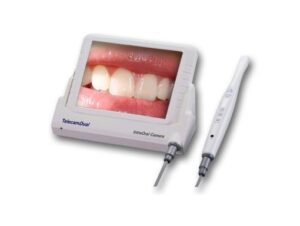 intraoral-camera-510x384 M-868 Wired Song CCD Intraoral Camera + 8inch LCD Monitor