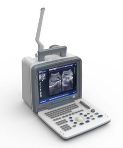 Portable LED screen ultrasound